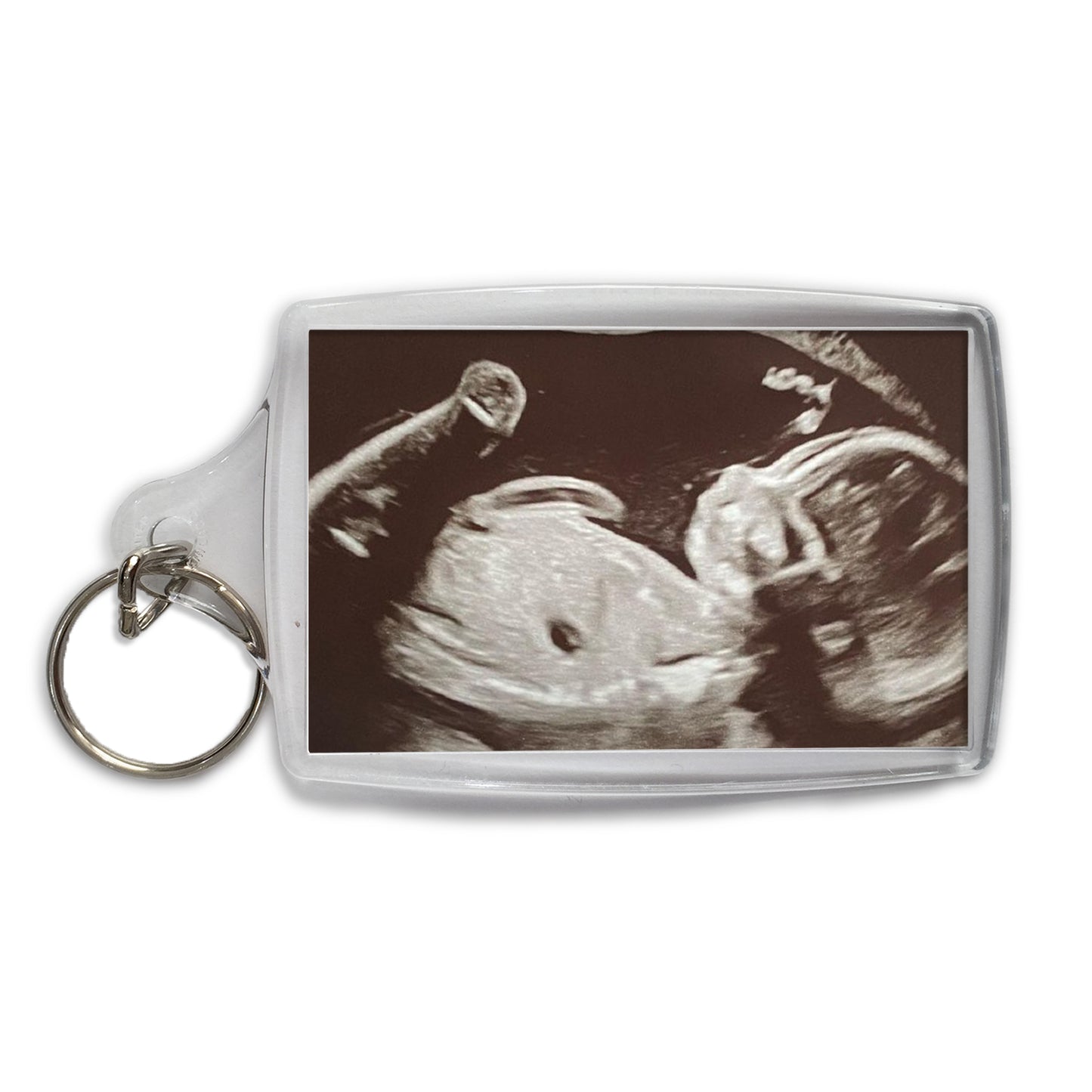 Personalised Baby Scan Photo Keyring