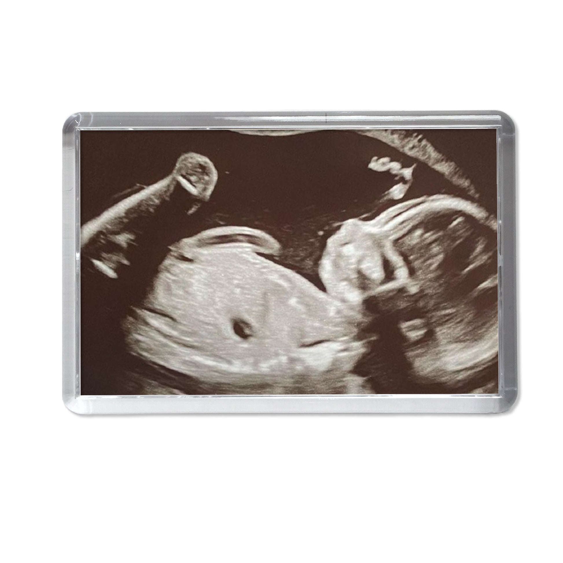 Personalised Baby Scan Photo Magnet
